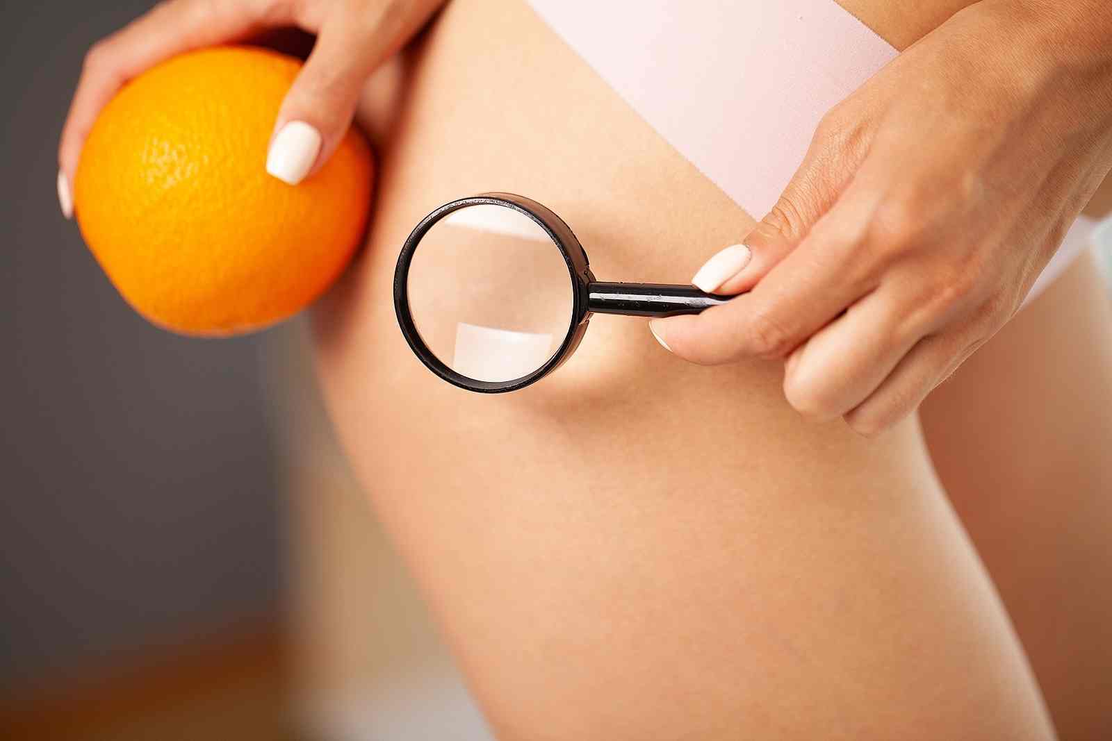 WHAT IS CELLULITE AND HOW TO COMBAT IT?