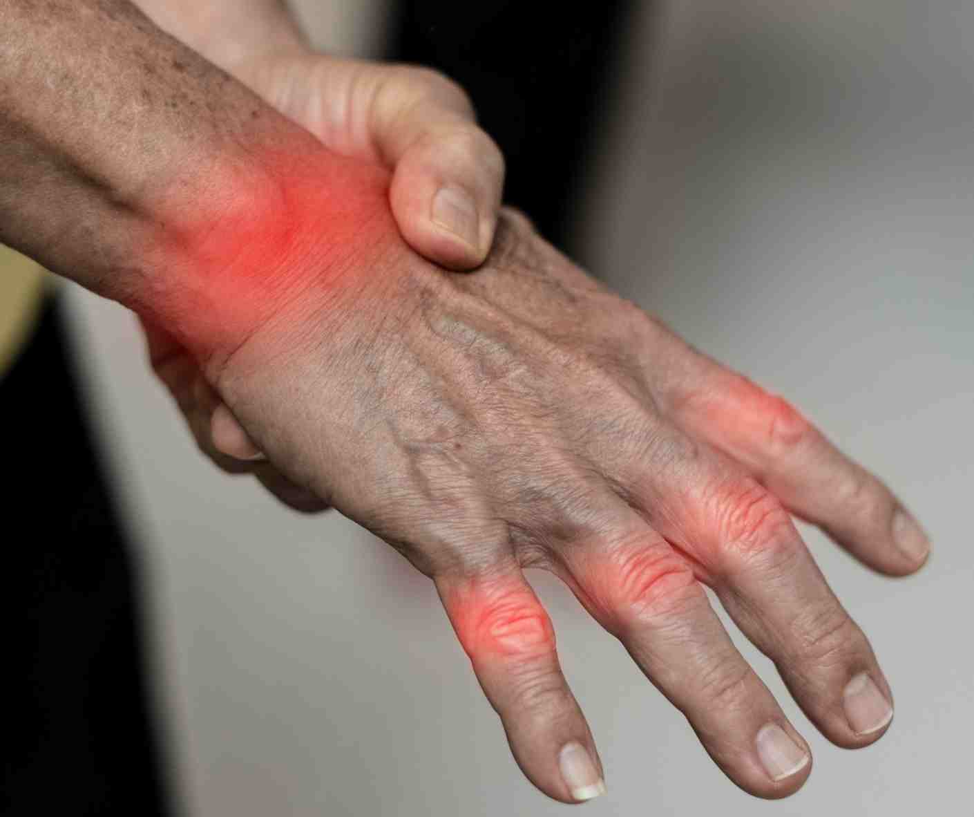 What Is Tendinitis? Experts Explain This Painful Condition