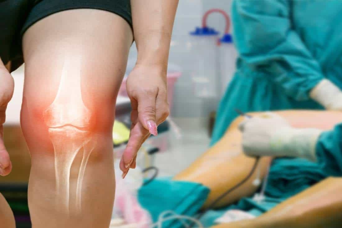 10 DOS AND DON’TS FOR MANAGING KNEE OSTEOARTHRITIS PAIN