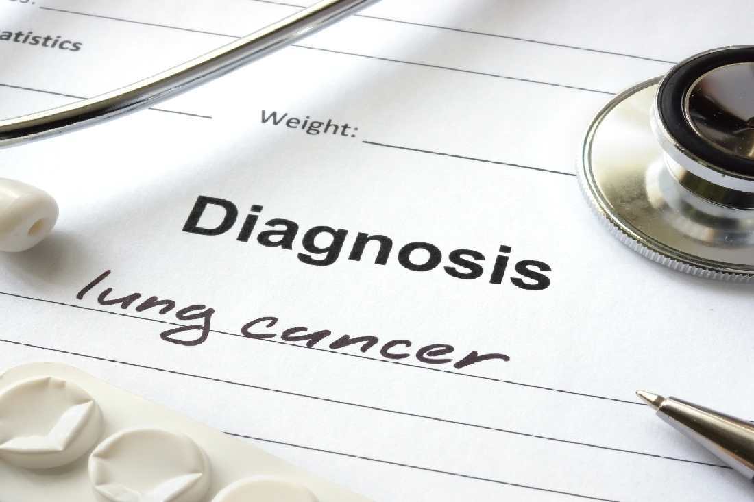 LUNG CANCER: RISK FACTORS AND PREVENTION