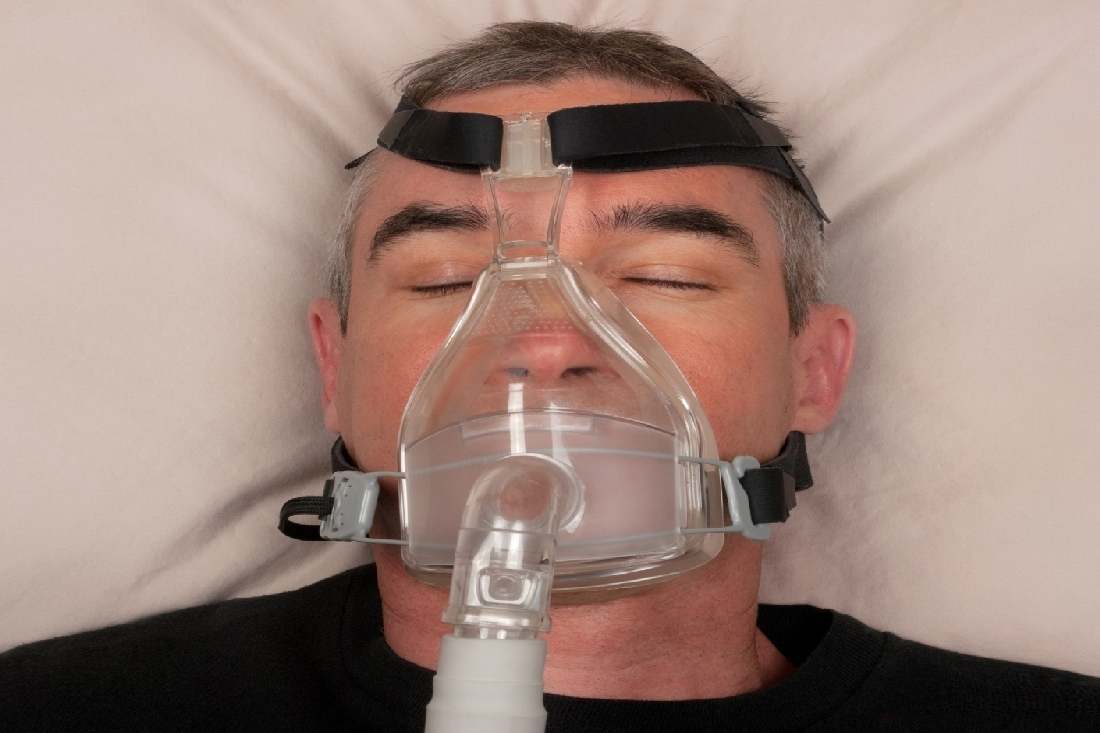 WHAT IS OBSTRUCTIVE SLEEP APNEA? SYMPTOMS, CAUSES, DIAGNOSIS, TREATMENT, AND PREVENTION