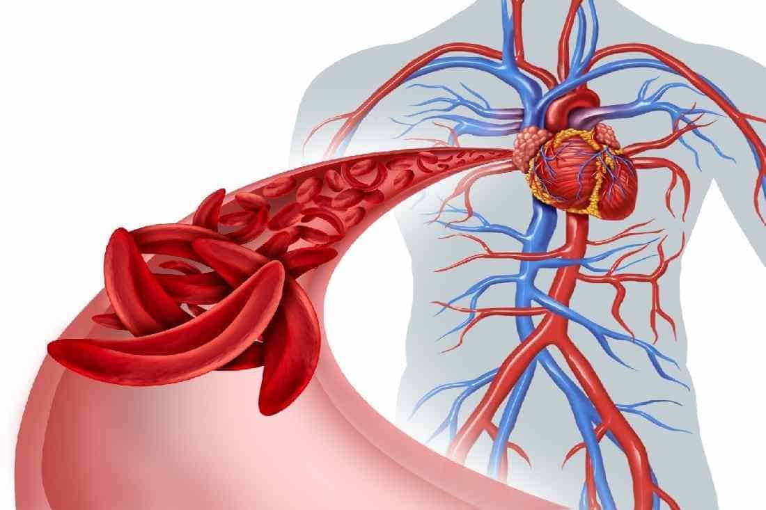 BLOOD CIRCULATION – WHY IT IS NECESSARY TO HAVE A GOOD CIRCULATION